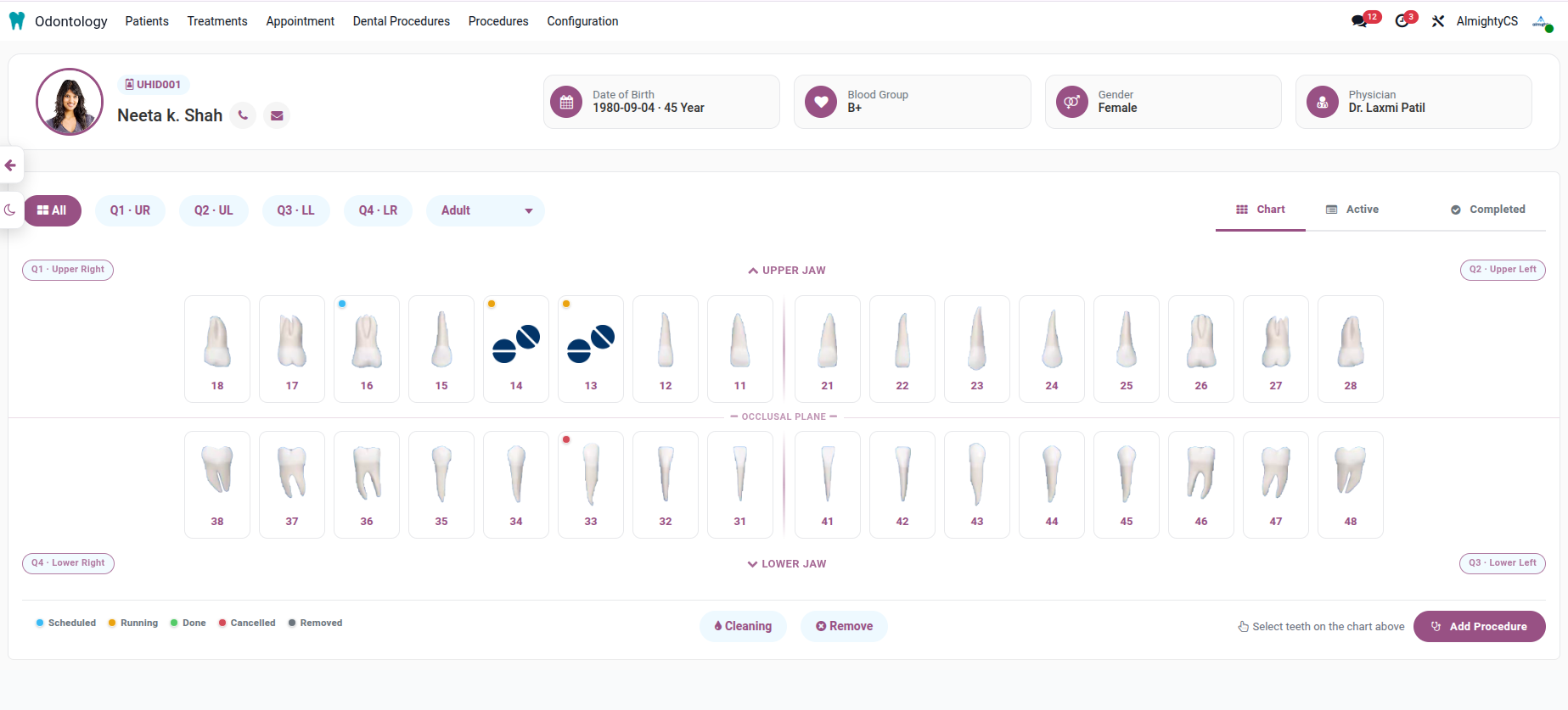 dental_chart_light