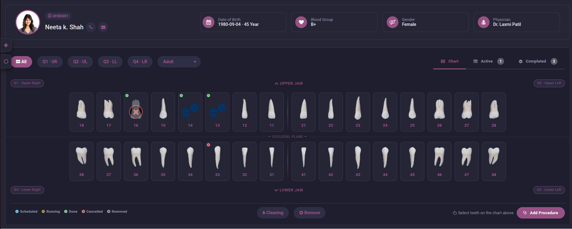 dental_chart_extra