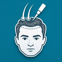Hair Transplant Management